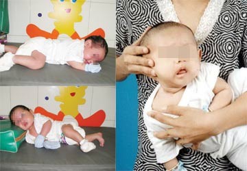 VẬT LÝ TRỊ LIỆU PHỤC HỒI CHỨC NĂNG THIÊN AN