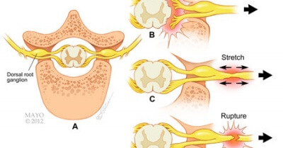 VẬT LÝ TRỊ LIỆU PHỤC HỒI CHỨC NĂNG THIÊN AN