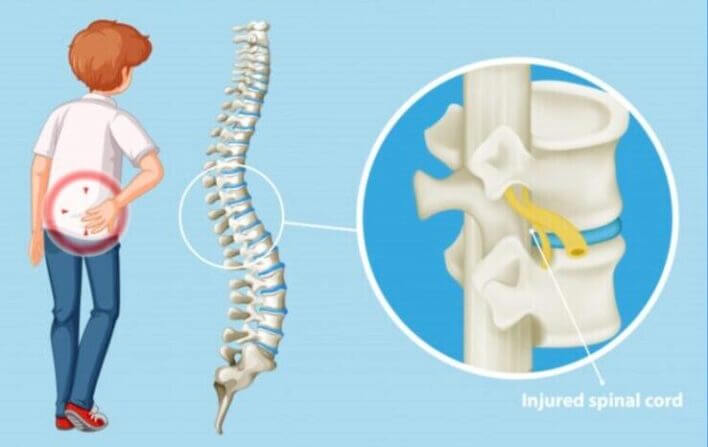 VẬT LÝ TRỊ LIỆU PHỤC HỒI CHỨC NĂNG THIÊN AN