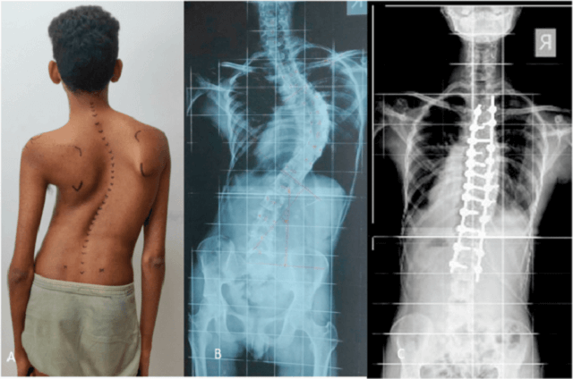 VẬT LÝ TRỊ LIỆU PHỤC HỒI CHỨC NĂNG THIÊN AN