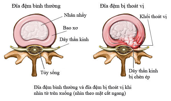 VẬT LÝ TRỊ LIỆU PHỤC HỒI CHỨC NĂNG THIÊN AN