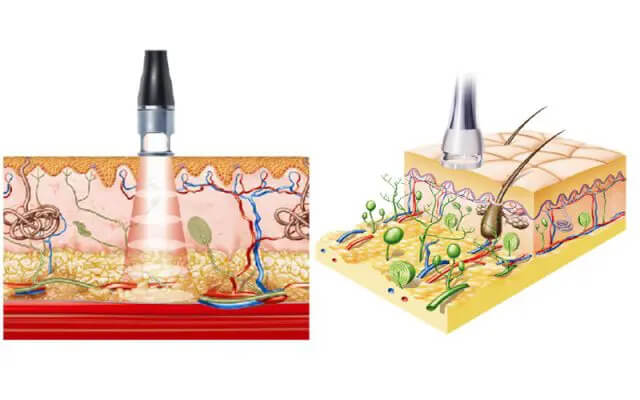 VẬT LÝ TRỊ LIỆU PHỤC HỒI CHỨC NĂNG THIÊN AN