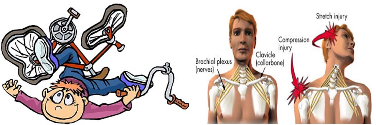 VẬT LÝ TRỊ LIỆU PHỤC HỒI CHỨC NĂNG THIÊN AN