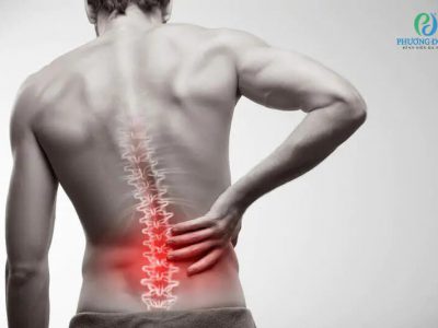 Đau dây thần kinh liên sườn - Nguyên nhân, triệu chứng và cách điều trị