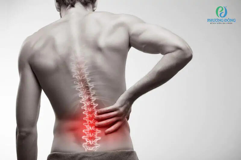 Đau dây thần kinh liên sườn - Nguyên nhân, triệu chứng và cách điều trị