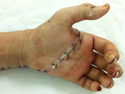 VẬT LÝ TRỊ LIỆU PHỤC HỒI CHỨC NĂNG THIÊN AN