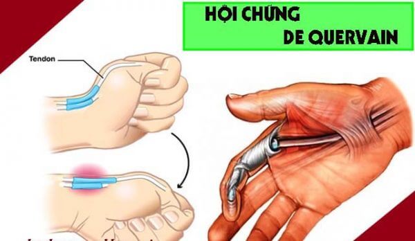 VẬT LÝ TRỊ LIỆU PHỤC HỒI CHỨC NĂNG THIÊN AN