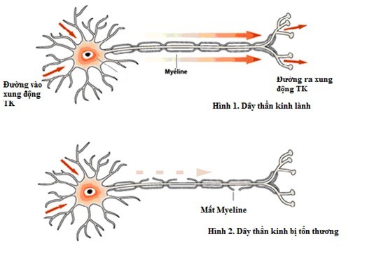 VẬT LÝ TRỊ LIỆU PHỤC HỒI CHỨC NĂNG THIÊN AN