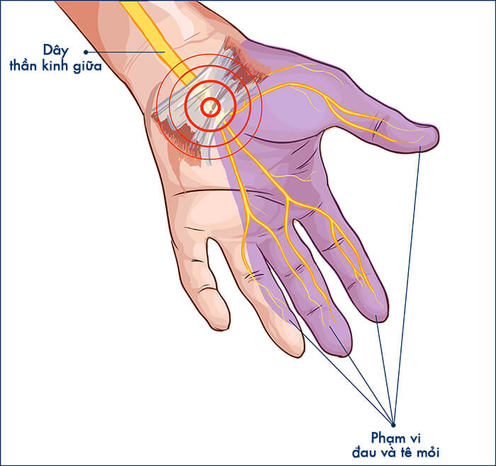 VẬT LÝ TRỊ LIỆU PHỤC HỒI CHỨC NĂNG THIÊN AN