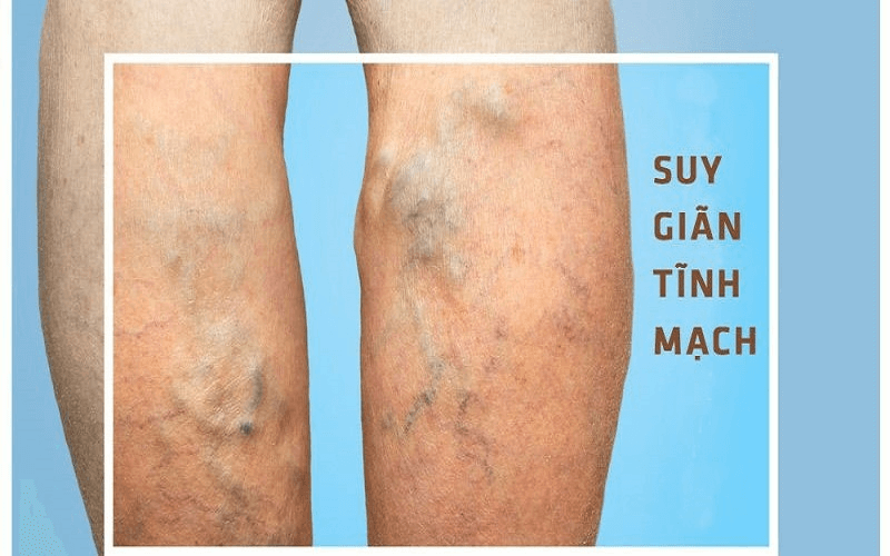 VẬT LÝ TRỊ LIỆU PHỤC HỒI CHỨC NĂNG THIÊN AN