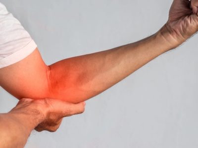 VIÊM ĐIỂM BÁM LỒI CẦU NGOÀI KHỦYU TAY (Tennis Elbow)