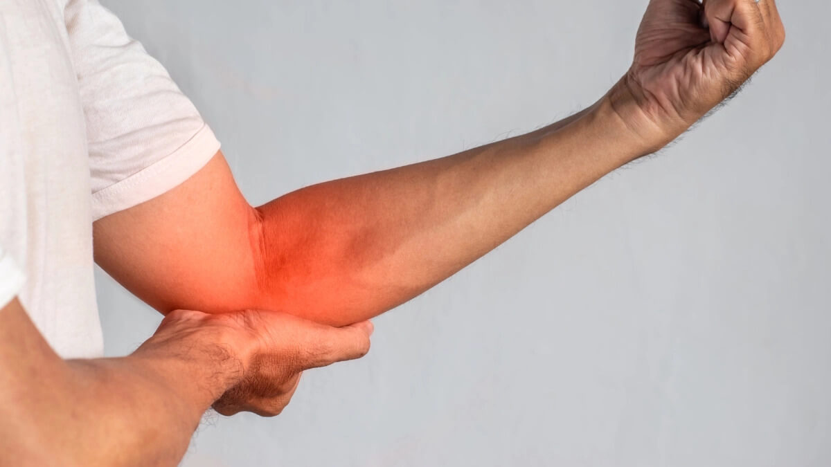 VIÊM ĐIỂM BÁM LỒI CẦU NGOÀI KHỦYU TAY (Tennis Elbow)