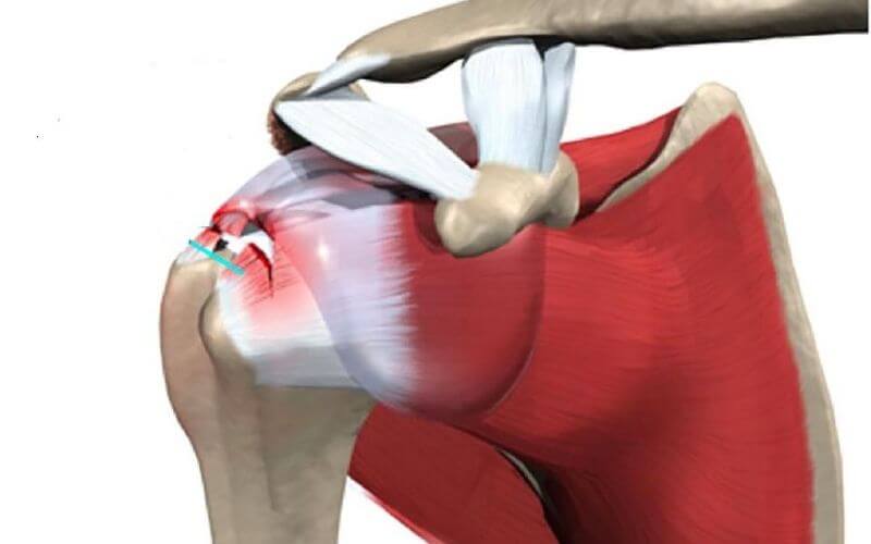 VẬT LÝ TRỊ LIỆU PHỤC HỒI CHỨC NĂNG THIÊN AN