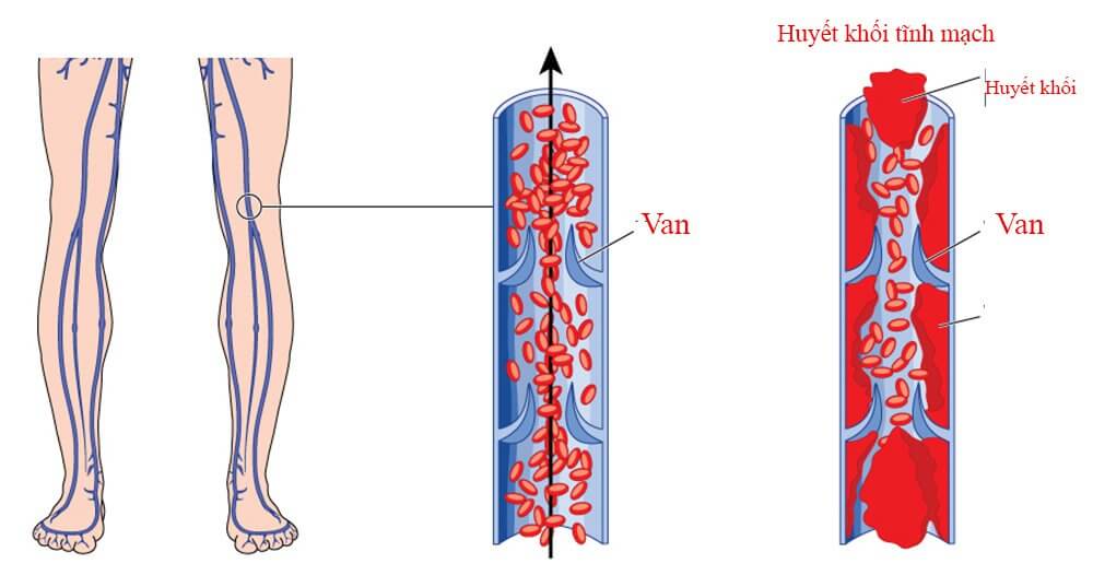 VẬT LÝ TRỊ LIỆU PHỤC HỒI CHỨC NĂNG THIÊN AN