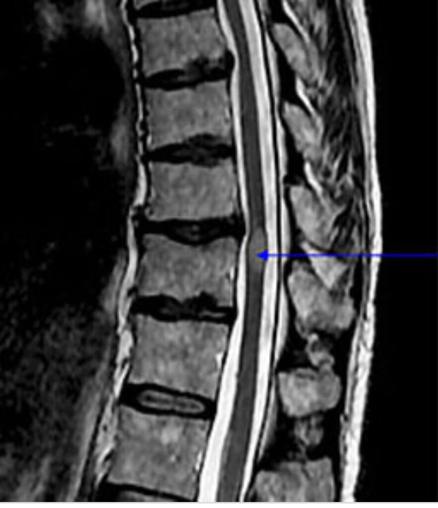 VẬT LÝ TRỊ LIỆU PHỤC HỒI CHỨC NĂNG THIÊN AN