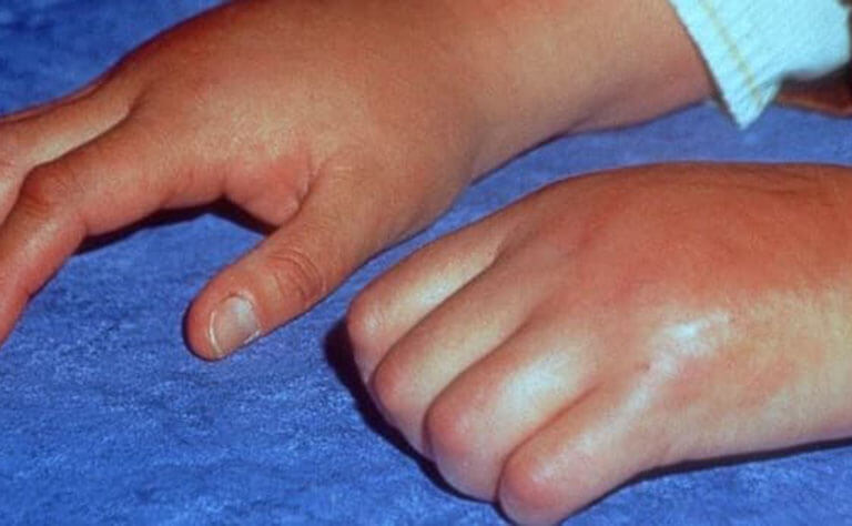 VẬT LÝ TRỊ LIỆU PHỤC HỒI CHỨC NĂNG THIÊN AN