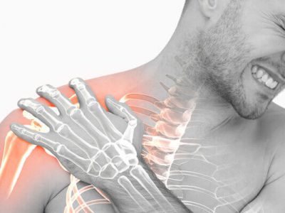 Phục hồi chức năng sau gãy xương đòn