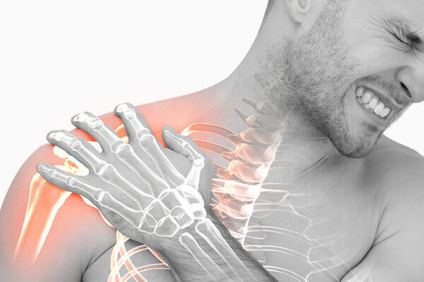 Phục hồi chức năng sau gãy xương đòn