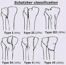 VẬT LÝ TRỊ LIỆU PHỤC HỒI CHỨC NĂNG THIÊN AN
