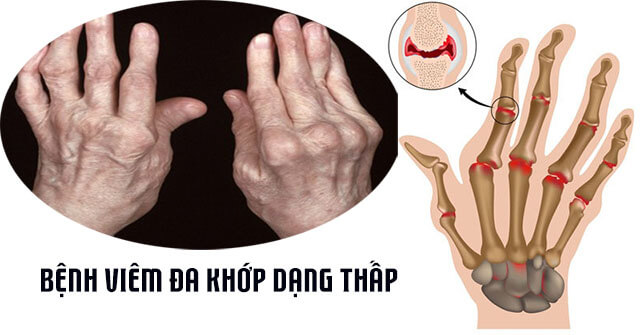 VẬT LÝ TRỊ LIỆU PHỤC HỒI CHỨC NĂNG THIÊN AN