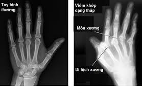 VẬT LÝ TRỊ LIỆU PHỤC HỒI CHỨC NĂNG THIÊN AN